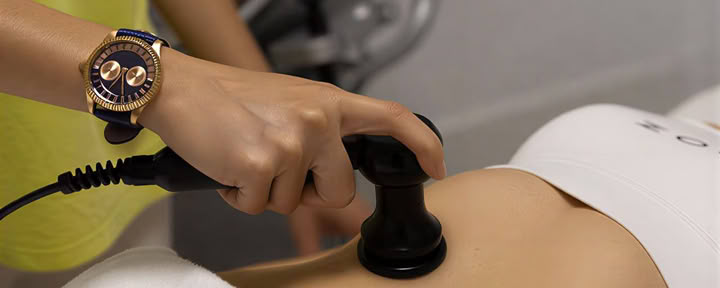 Tratamiento de radiofrecuencia